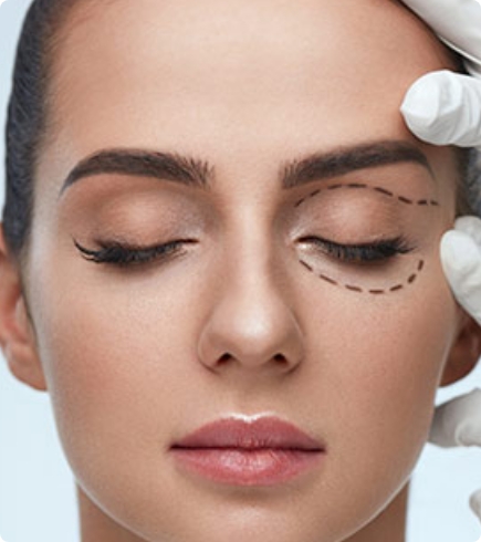 Blépharoplastie